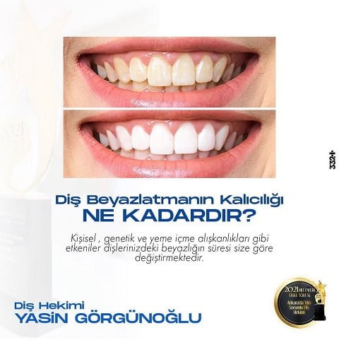 Diş Beyazlatma Tedavisi Yasin Görgünoğlu