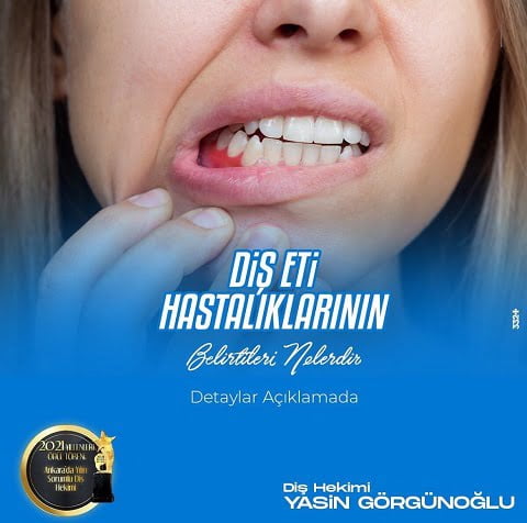 Diş eti hastalıkları resmi